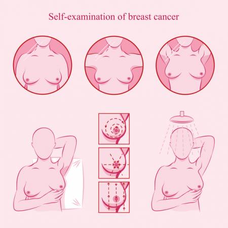 Breast Self Examination - What to Do?